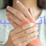روماتیسم