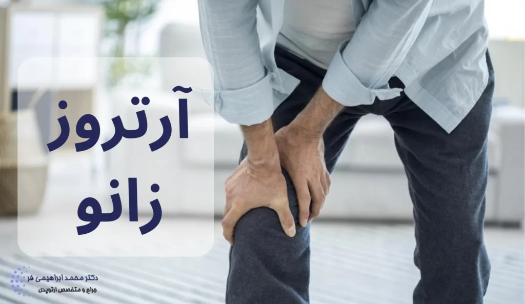 آرتروز زانو