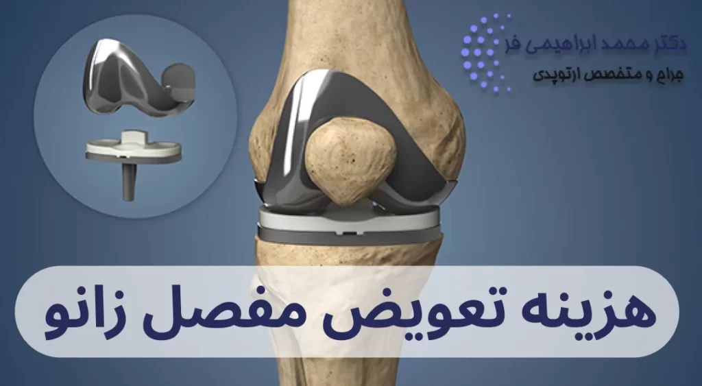 هزینه تعویض مفصل زانو