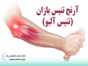 درمان آرنج تنیس بازان