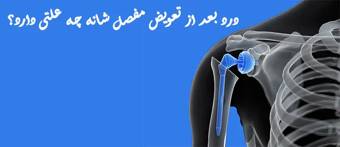 درد بعد از تعویض مفصل در ناحیه شانه