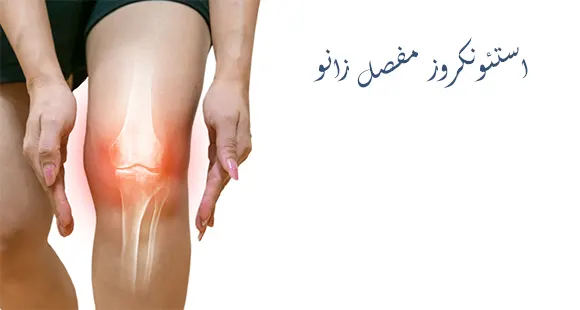 استئونکروز مفصل زانو