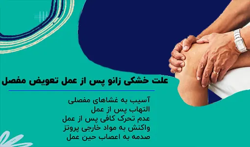 خشکی زانو بعد از تعویض مفصل زانو
